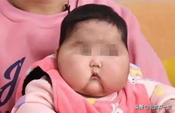 大头娃娃病症状,大头娃娃病症的原因