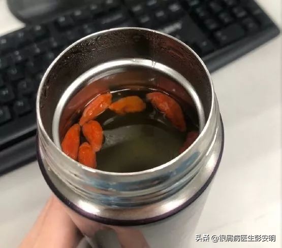 男人每天一把枸杞子,每日一把枸杞子你想不到的功效