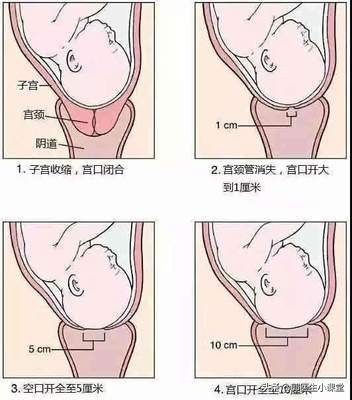 顺产时的开十指是将手全部塞进去吗？
