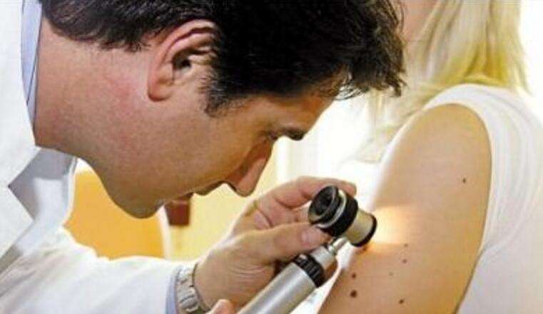 皮肤上长了一个痣怎么办,皮肤上长痣是什么癌