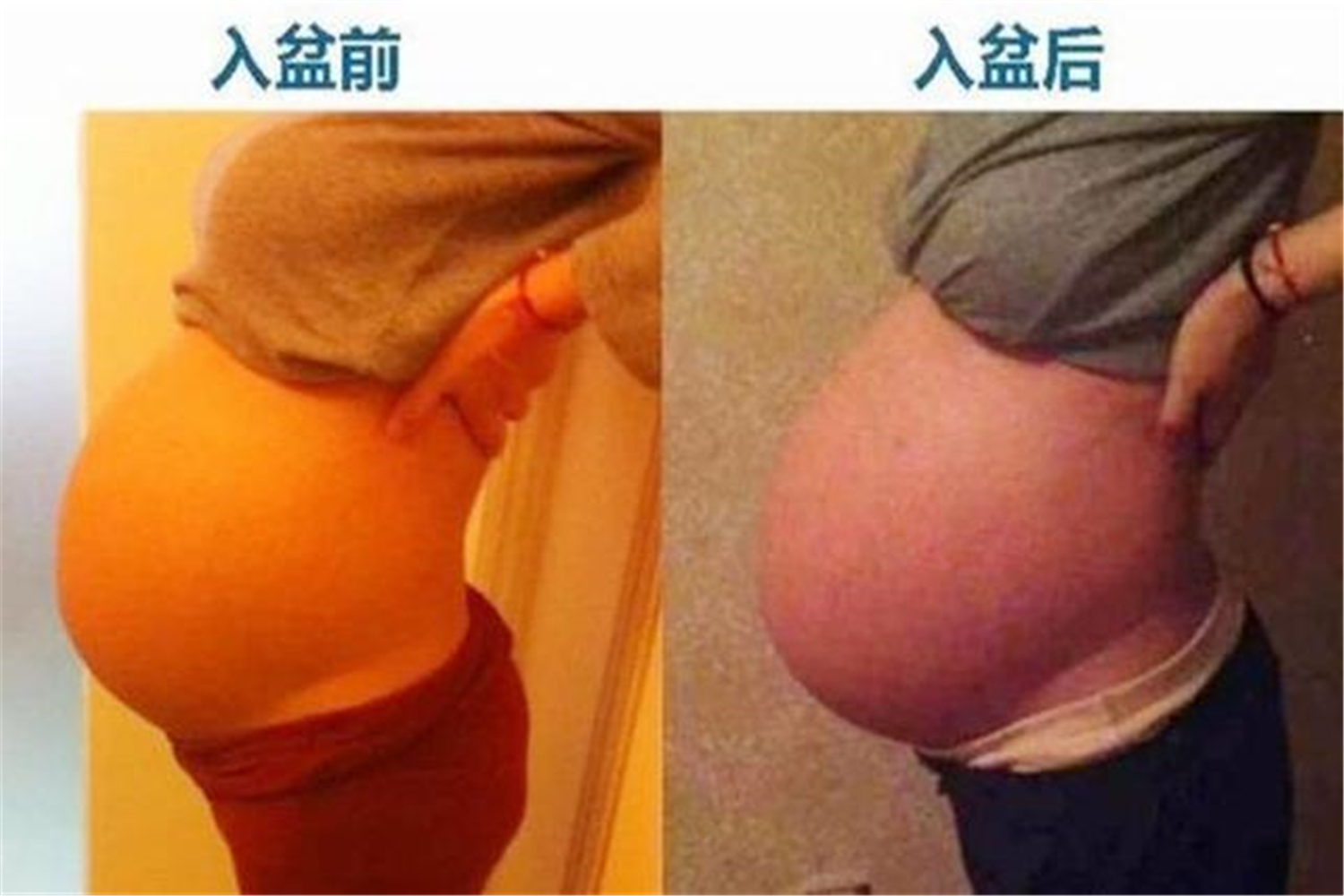 孕晚期腹部下方疼痛是入盆吗,孕晚期入盆后胎动引起的小腹疼