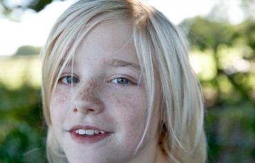 脸上长斑是激光还是用祛斑产品好,50岁年龄脸上长斑怎样能祛斑