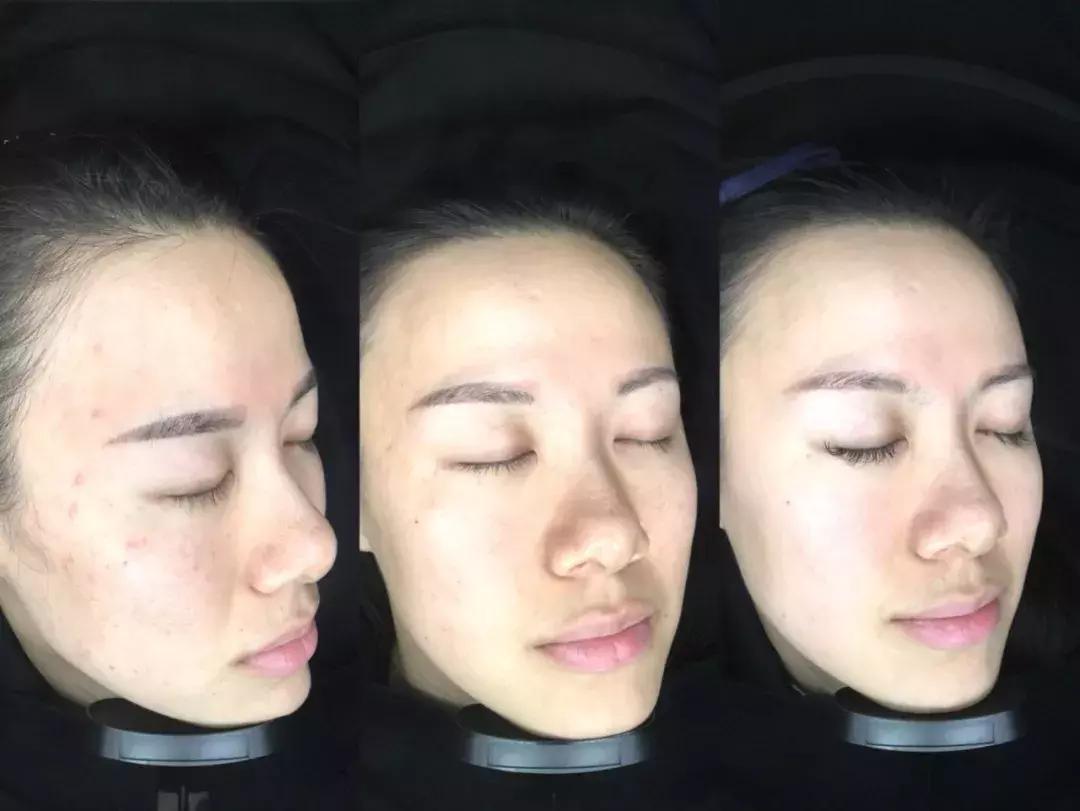 生完孩子变漂亮了,生完孩子反而变美了