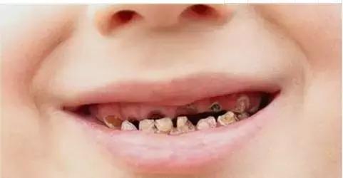 儿童常见疾病家长该如何干预,6个最易被忽视的儿童危险因素