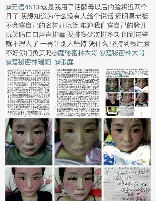 张庭林瑞阳公司违法吗,关于张庭林瑞阳微商评价