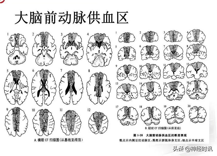 脑动脉解剖学讲解,基底节区脑血管解剖