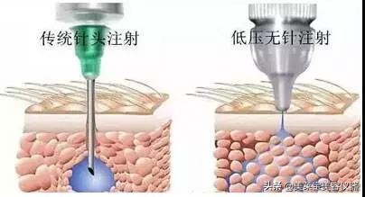 有无创水光针仪器吗,水光针和无创水光