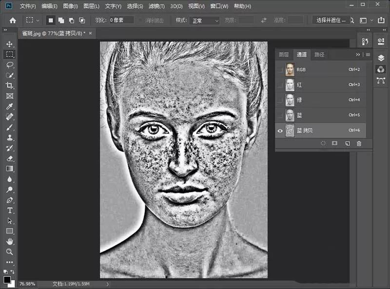 祛除脸部雀斑最有效的方法,有什么日常方法可以去除脸上雀斑