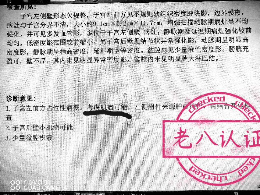 一个特殊子宫的“去与留”