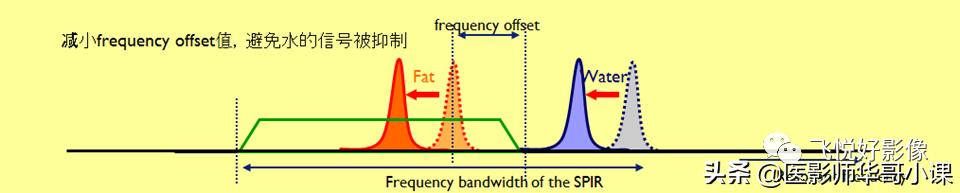 飞利浦磁共振独有技术,飞利浦磁共振减影技术