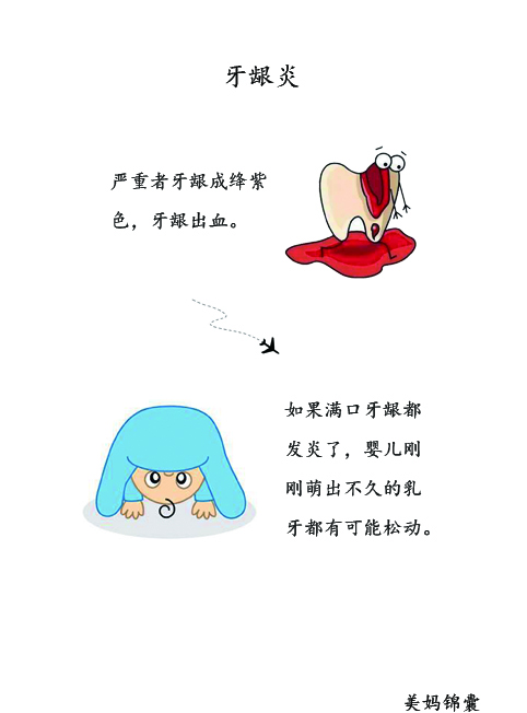 睡着时怎么判断孩子舌系带过短,孩子舌系带过短矫正的最佳时间