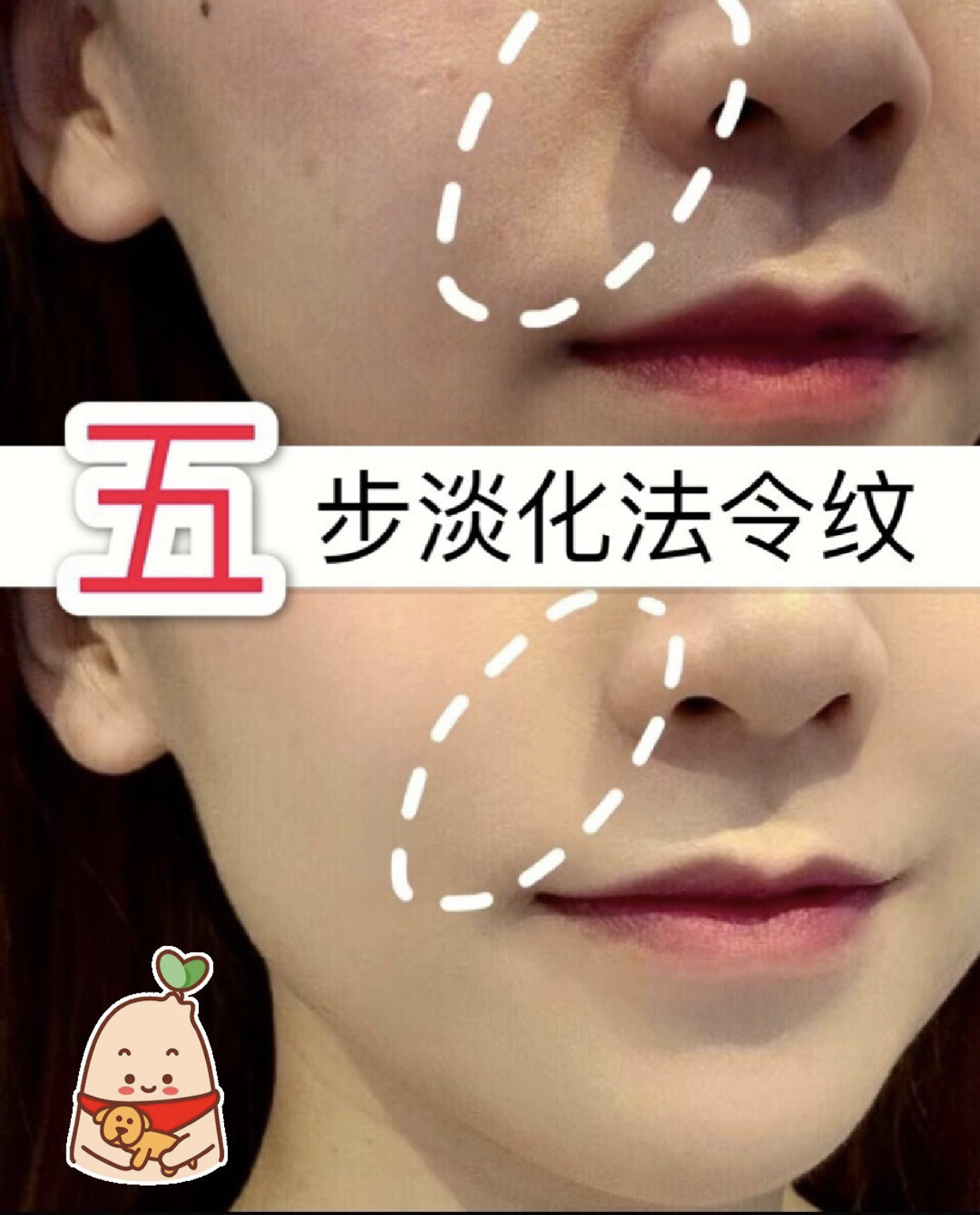 抗皱淡化法令纹面霜,淡化法令纹的美容仪