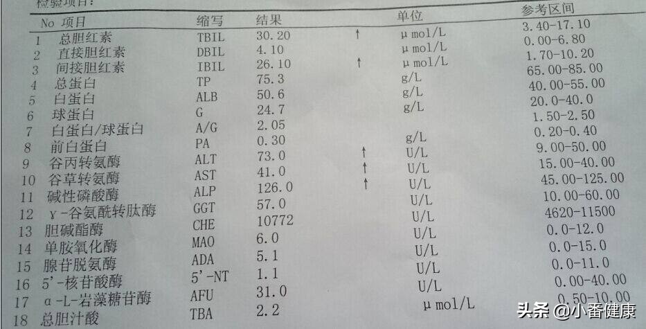 乙肝病毒e抗体145项有危害吗,遗传性乙型肝炎肝硬化