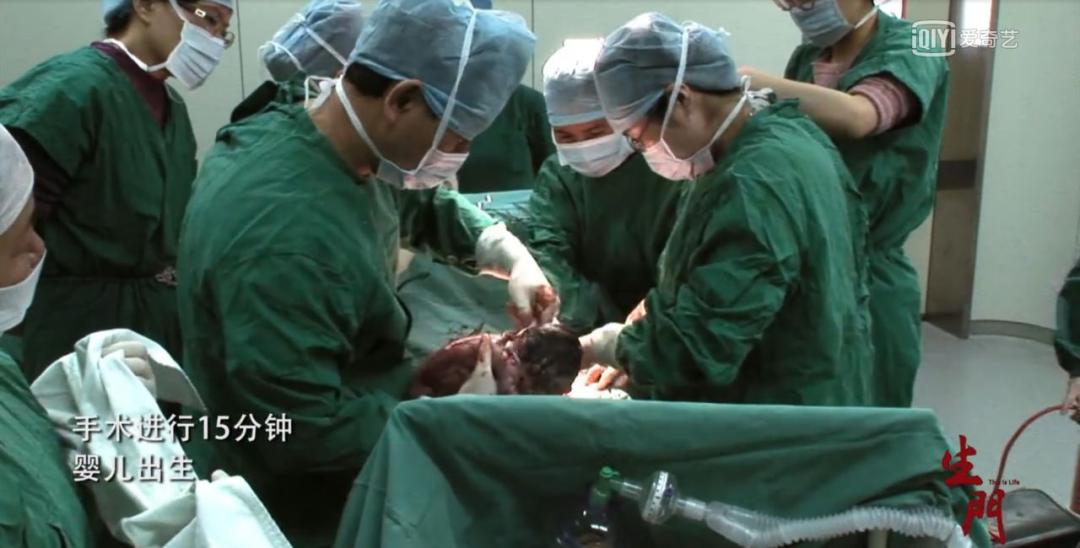 27岁产妇冒死双胞胎后续,高龄产妇冒死生宝宝