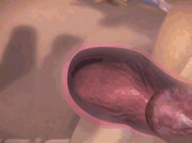 顺产究竟有多疼看完你就清楚了,如何减轻顺产生孩子疼痛