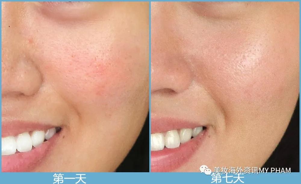 露得清哪个牌子适合混合肌肤,露得清抗老紧致