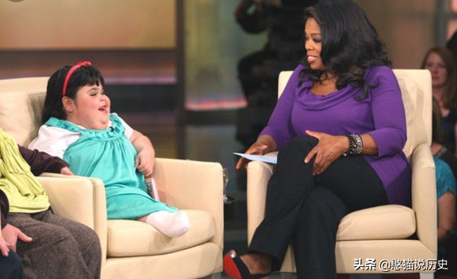 美人鱼真实存在的5件事,美人鱼婴儿畸形手术