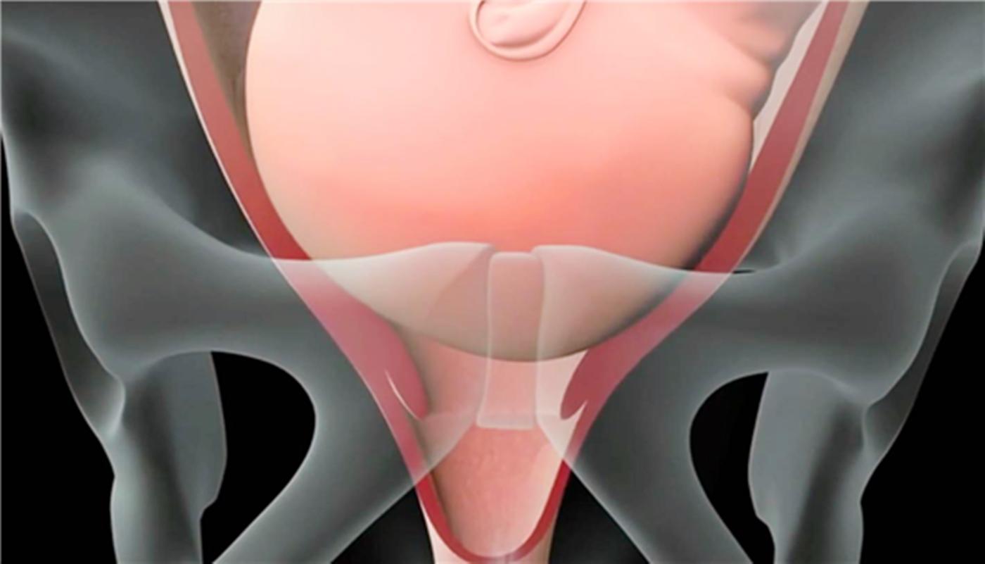 产道那么窄孩子怎么能生得出来呢,胎儿是怎么从狭小的产道出生的