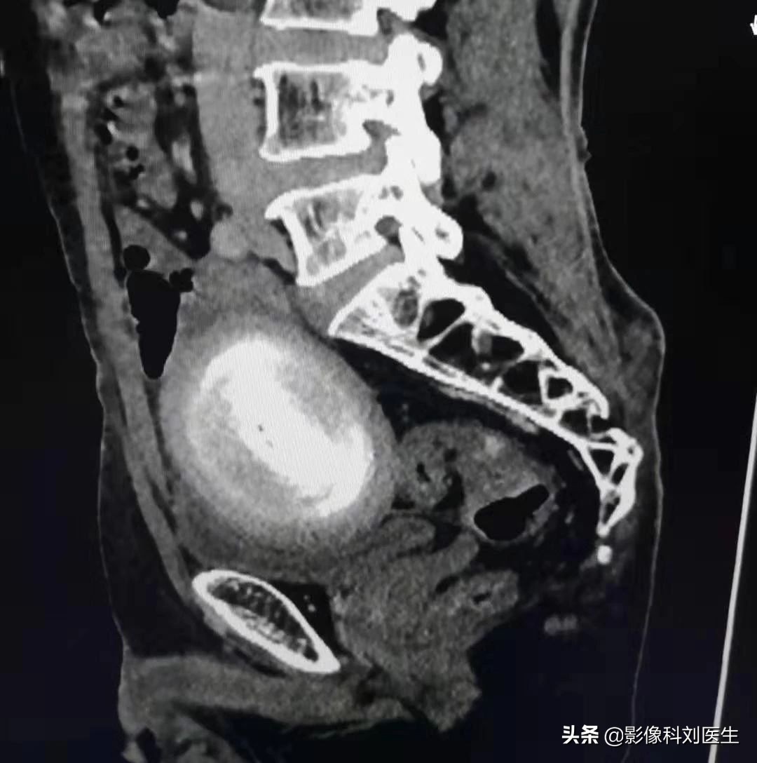 88岁的老大爷肚子痛是怎么回事,88岁大爷肚子痛