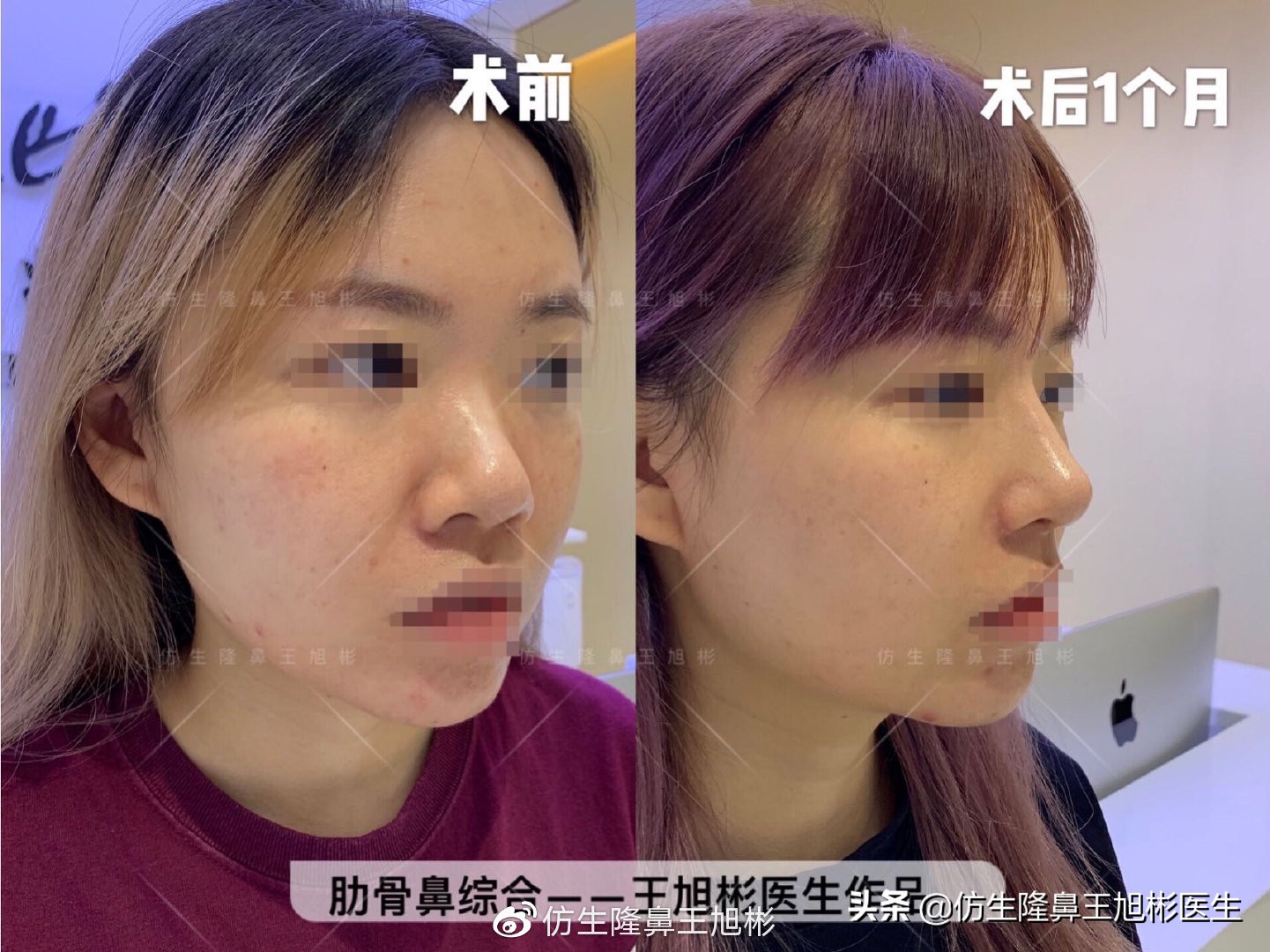 被鼻子封印的颜值,那些被鼻子封印的颜值