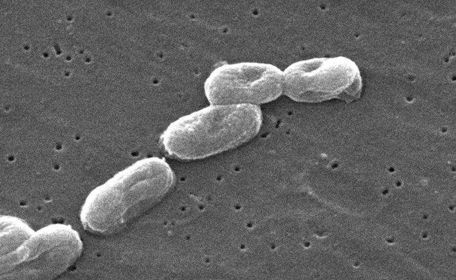 美国出现多起类鼻疽确诊病例，追踪溯源，目标再指德特里克堡