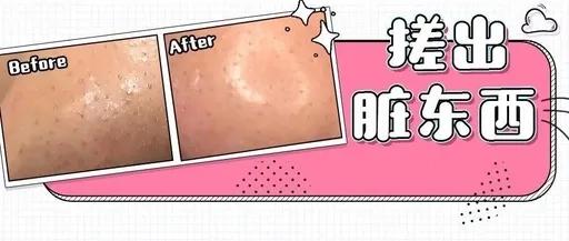 脸部清洁产品推荐干皮敏感肌,干皮清洁脸部产品推荐