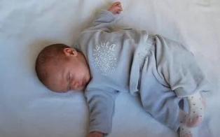 宝宝哭引起肠管扩张,宝宝哭的时候就会有脐疝