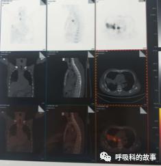 怎么应用统计学做调查,统计学方法可以解决的主要问题