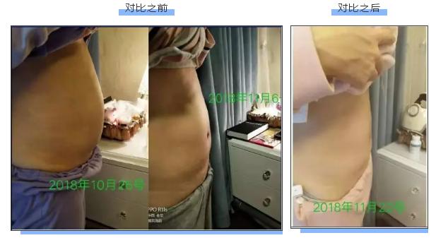 生完孩子月子里怎么恢复得快,坐完月子后身材就可以恢复正常了