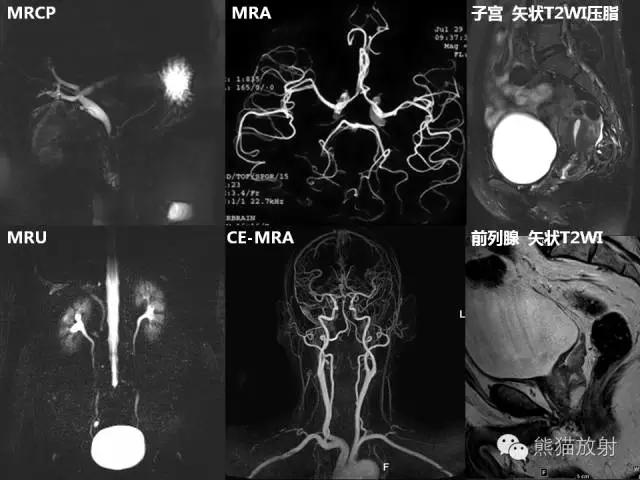 如何简单理解、认识MRI图像