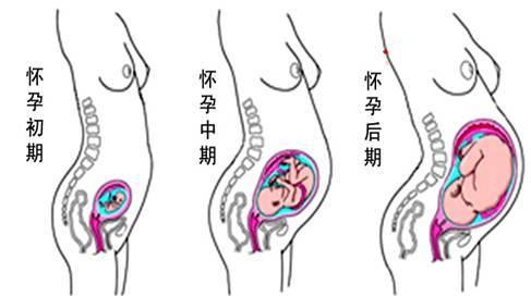 盆底康复操视频教程,生完孩子6年了盆底肌可以修复吗