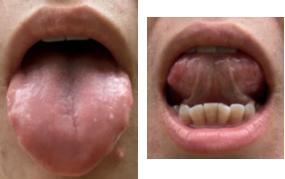 月经崩漏按哪个穴位能止血,月经崩漏止血中药方