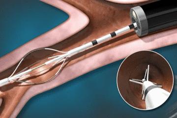 手术的时候医生对你做了什么,手术时切了一片肺叶