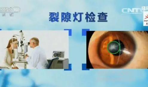 警惕偷走视力的小偷,这六种病会偷走你的视力