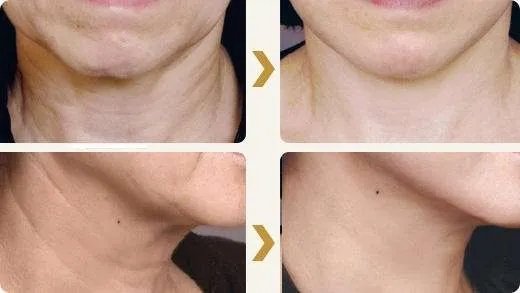 18岁的脸40岁的脖子，你们要的去颈纹指南来啦