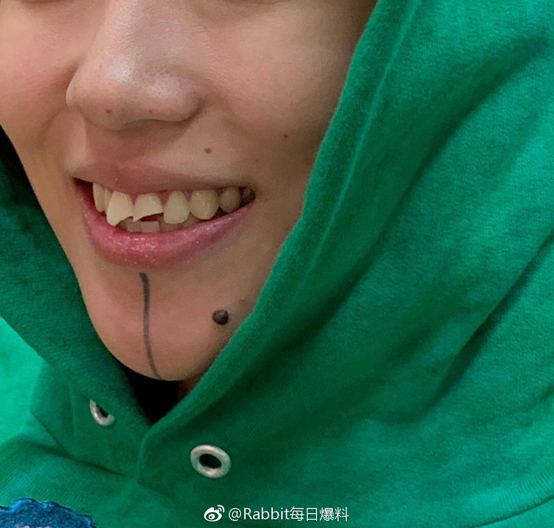 窦靖童门牙笑容灿烂,窦靖童磕破门牙