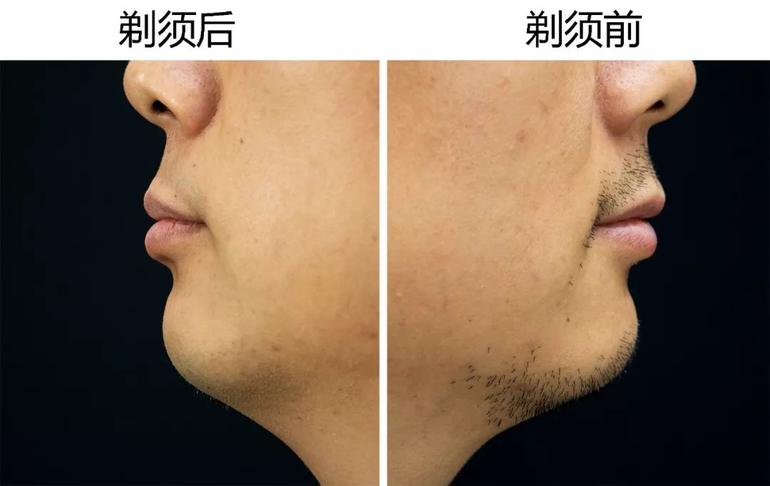 飞利浦s9000剃须刀怎么连接蓝牙,飞利浦s9000剃须刀怎么安装视频