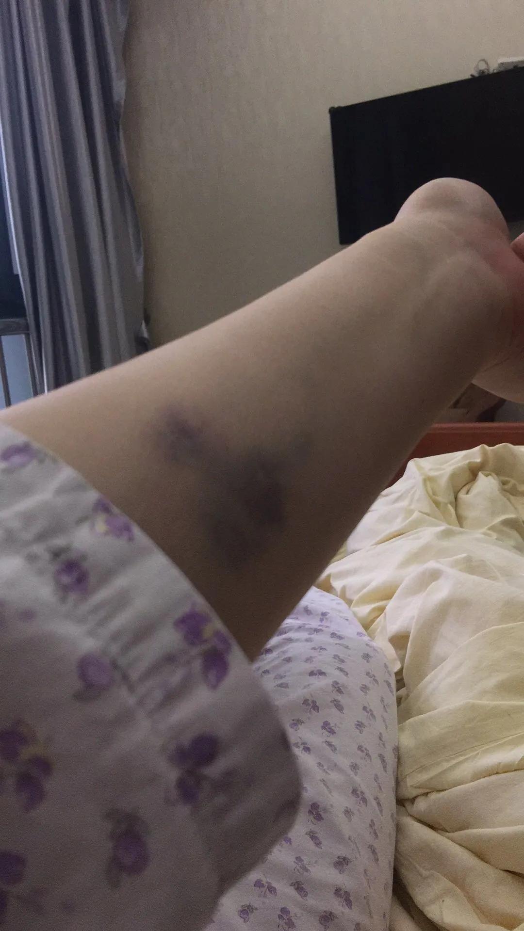 当取卵针戳进我的卵巢时,丈夫在看片取精|成为母亲