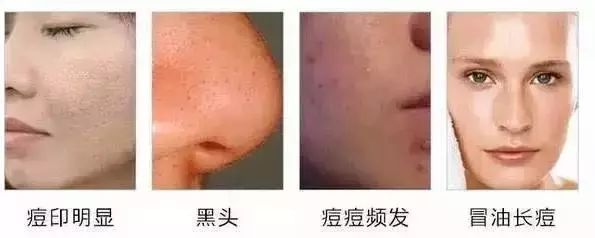 多久化一次妆皮肤能代谢掉,卸一次妆要用8天