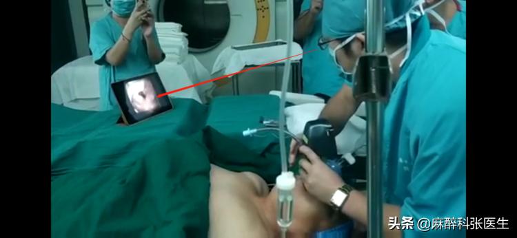 Airtraq氧瞬得，气管插管的最佳解决方案！