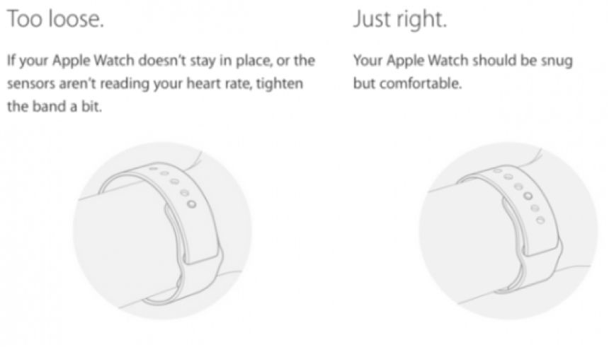 佩戴applewatch过敏能退吗,applewatch戴着皮肤过敏