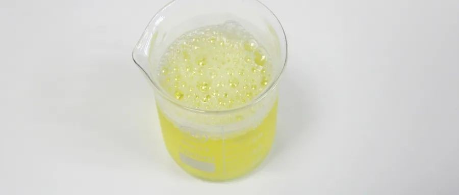 尿常规大部分人都做错了，想要准确的检测结果就要选择这样留尿