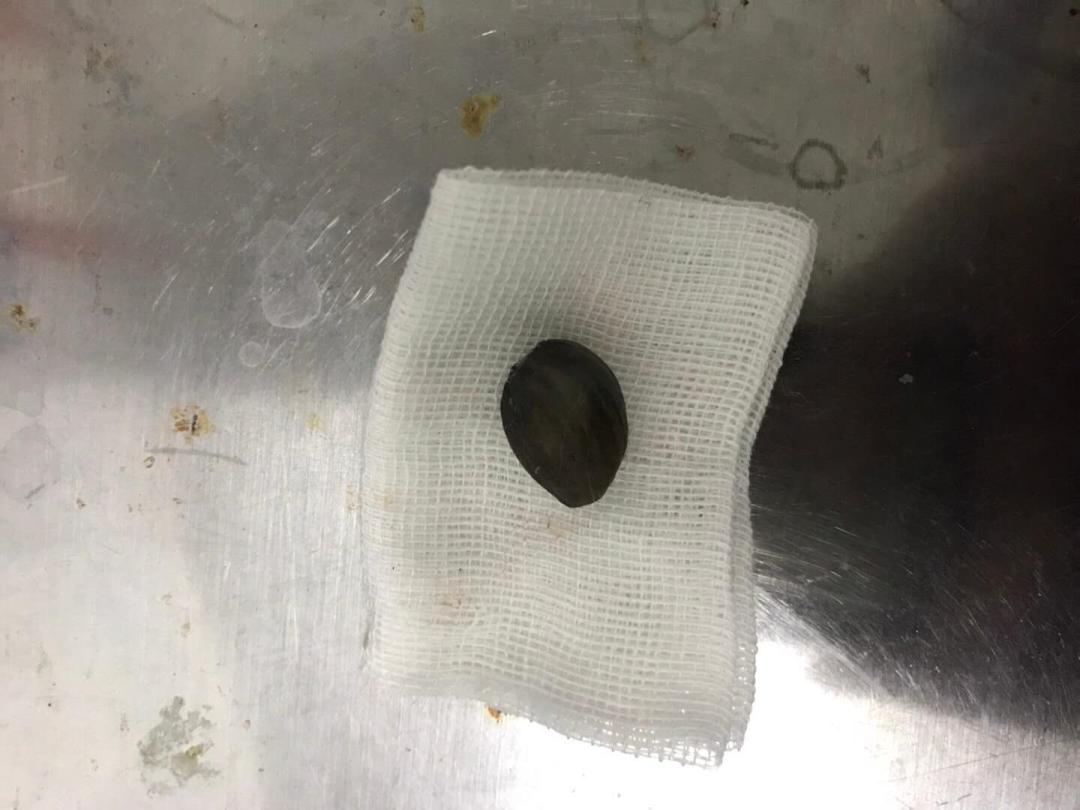 “我居然从猫屁股拽出了一根针！太可怕了！”