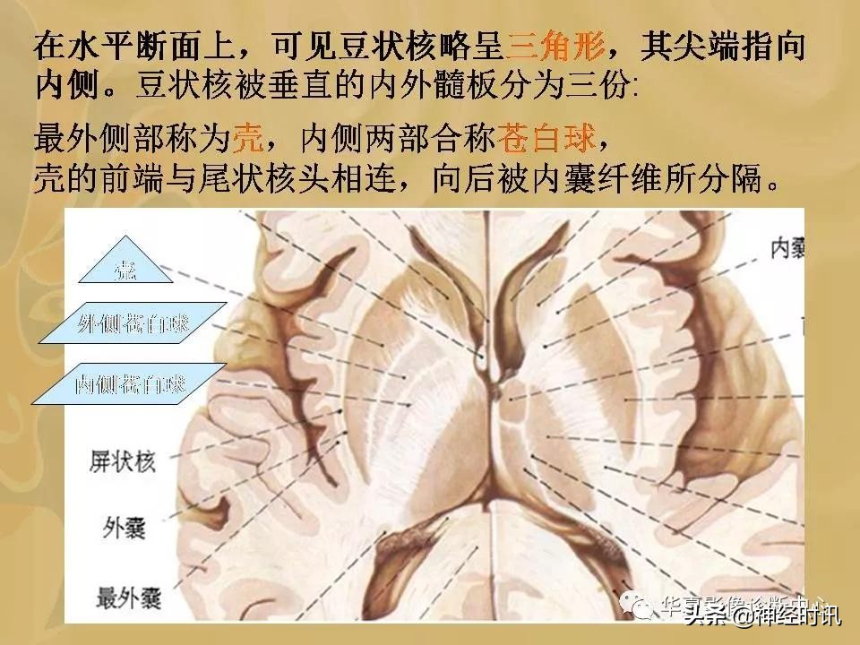 基底节ct解剖示意图,影像解剖图谱怎么用