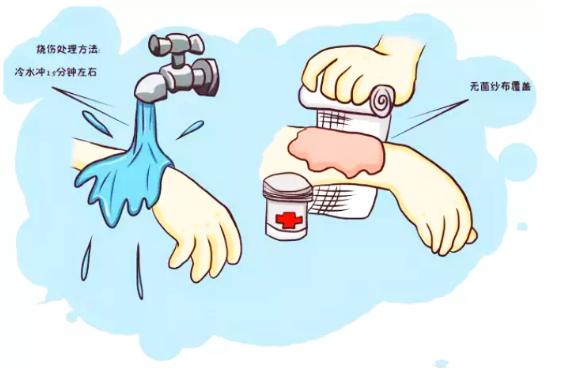 网红夫妻火灾毁容直播,网红前夫用汽油烧伤直播回顾