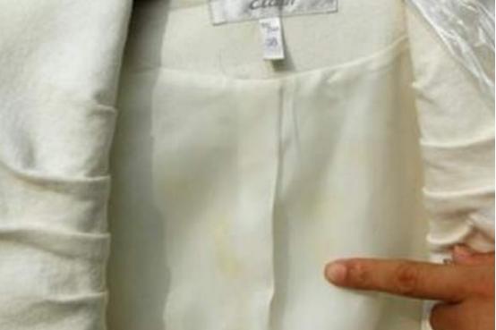 衣服变黄了有什么方法能洗掉,衣服变黄用什么能洗白