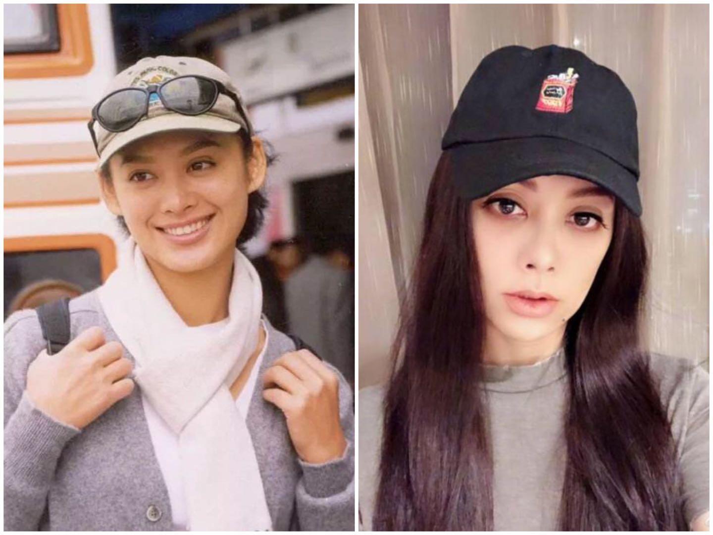 为了变美到底该不该打玻尿酸,玻尿酸注射后变丑了怎么办