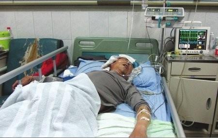 哪几个症状告诉你身体出现了血栓,医生提醒出现五个症状要注意