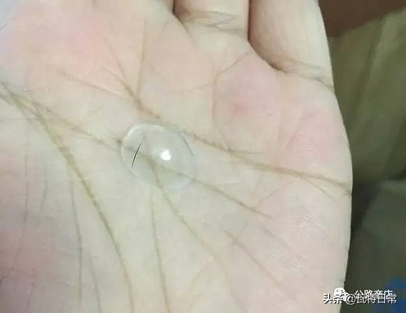 都别动！我掉了一只隐形眼镜