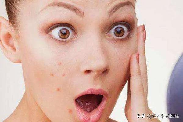 怀孕真的会变丑没有例外,孕妇怀孕期间都会变丑吗